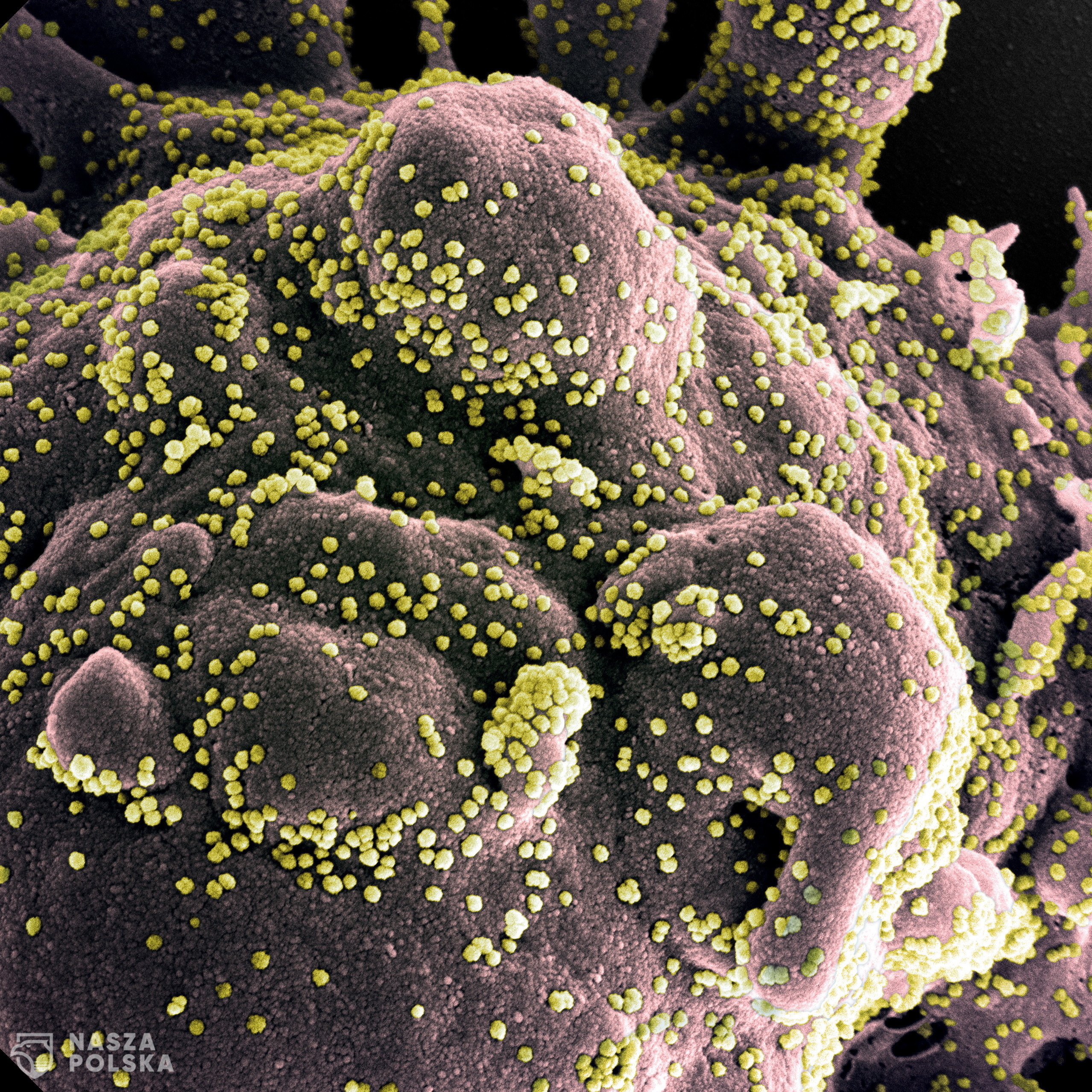 epa08378696 An undated handout image captured and color-enhanced at the National Institute of Allergy and Infectious Diseases (NIAID) Integrated Research Facility (IRF) in Fort Detrick, Maryland, USA and made available by the National Institutes of Health (NIH) shows a colorized scanning electron micrograph of an apoptotic cell (gray) heavily infected with SARS-COV-2 virus particles (yellow), isolated from a patient sample (issued 23 April 2020). The novel coronavirus SARS-COV-2, which causes the COVID-19 disease, has been recognized as a pandemic by the World Health Organization (WHO) on 11 March 2020.  EPA/NIAID/NATIONAL INSTITUTES OF HEALTH HANDOUT  HANDOUT EDITORIAL USE ONLY/NO SALES 
Dostawca: PAP/EPA.