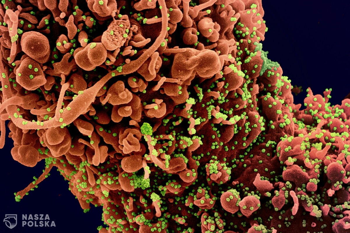 Badanie/ Osoby szczepione i nieszczepione mają podobną wiremię przy wariancie delta