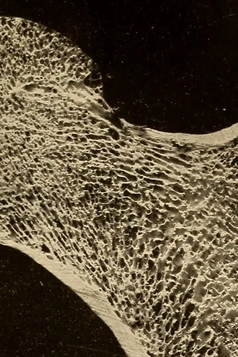 Osteoporoza to problem ponad 2 mln Polaków, głównie kobiet
